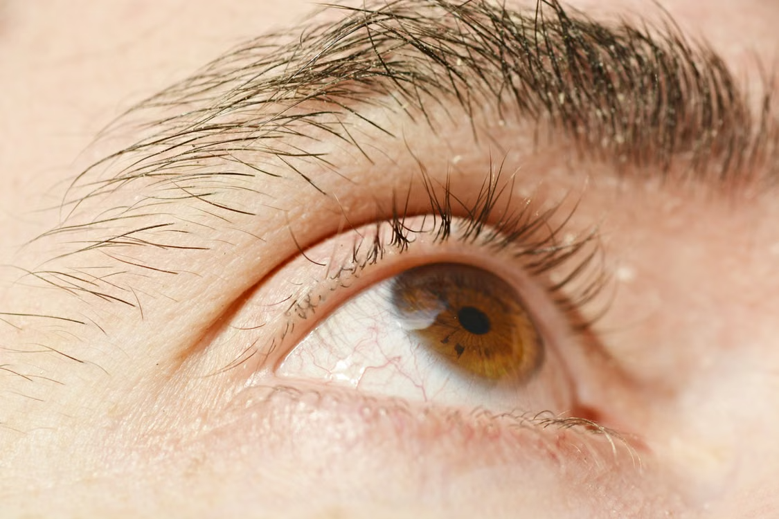 Eyelid Surgery Near Me: 10 Denver Must-Know Tips 2026